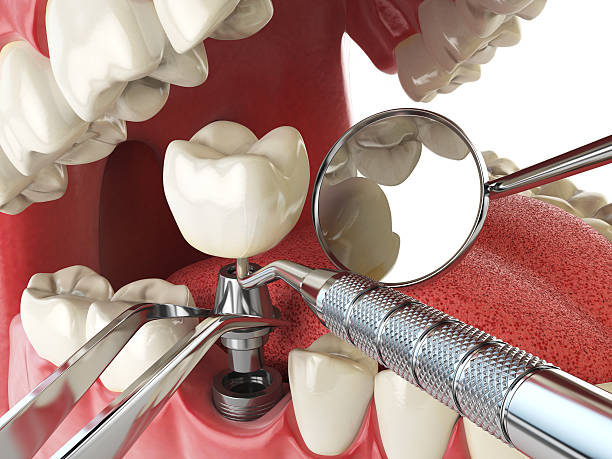 Best Emergency Dental Surgery in Coal City, IL